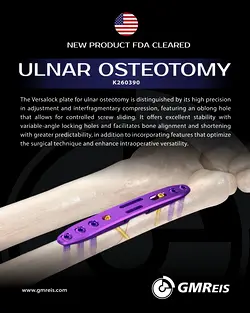 FDA Clears GMReis' Precision Ulna Shortening Plate System | Populer Platform