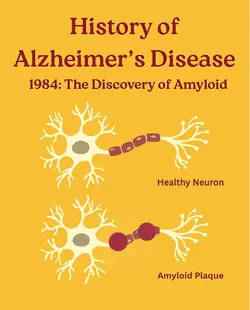 Alzheimer's Disease: 1984 Discovery of Amyloid & Modern Research Advances | Populer Platform