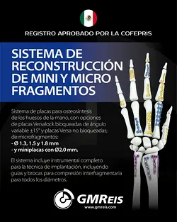 GMReis Expands Portfolio with New Versalock Registration in Mexico for Hand Fractures | Populer Platform