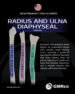 FDA Clearance Achieved: Advanced Anatomical Plate System for Radius and Ulna Fractures | Populer Platform